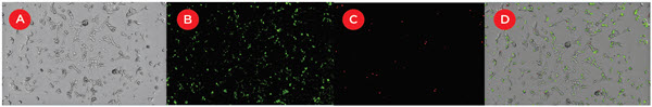 Figure 3. Measuring transfection efficiency and cytotoxicity. 24 hours after transfection with FAM-labeled siRNA oligonucleotides ACHN cells were stained with DRAQ7 to identify cytotoxic cells, and imaged with the SpectraMax MiniMax cytometer. A) Brightfield image utilized for total cell counts. B) 541 nm image utilized for transfected cell counts. C) 713 nm image utilized for dead cell count. D) Overlay of all three images.