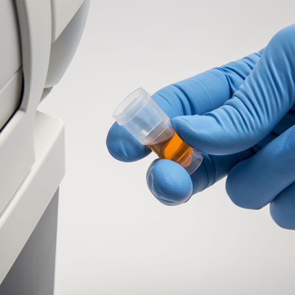 Vi-CELL MetaFLEX Analyzer cup of sample