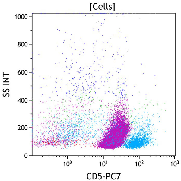 ClearLLab 10C, Case 14, CD5 vs Side Scatter dot plot, all viable cells