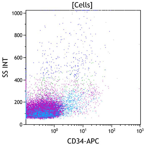 ClearLLab 10C, Case 14, CD34 vs Side Scatter dot plot, all viable cells