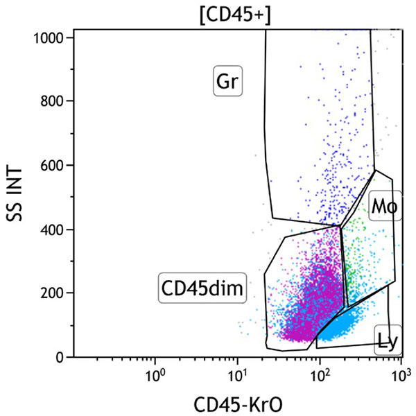 ClearLLab 10C, Case 14, CD45 vs Side Scatter dot plot, CD45+ gate