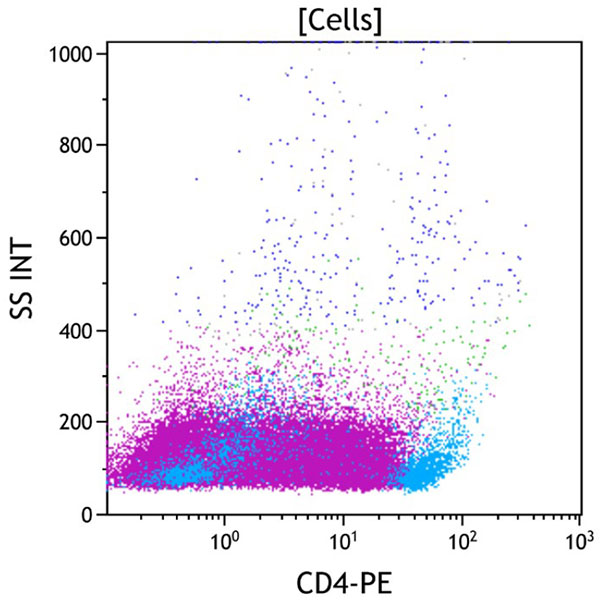 ClearLLab 10C, Case 14, CD4 vs Side Scatter dot plot, all viable cells