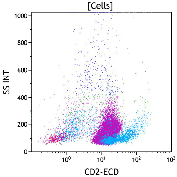 ClearLLab 10C, Case 14, CD2 vs Side Scatter dot plot, all viable cells