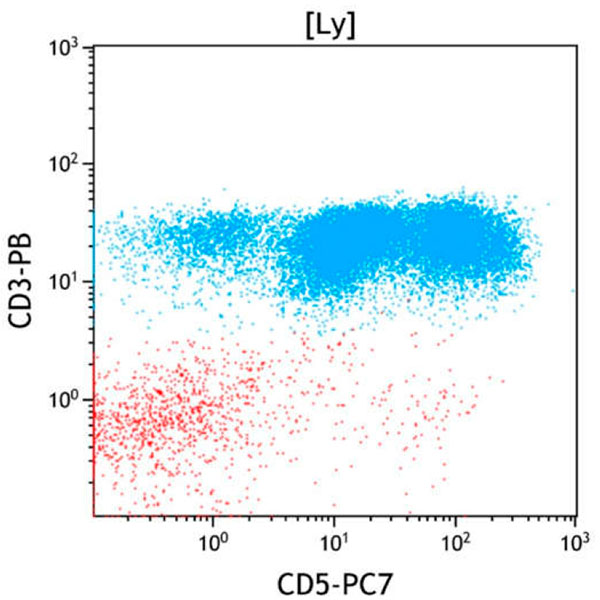 ClearLLab 10C, Case 16, CD5 vs CD3 dot plot, Lymphocyte gate
