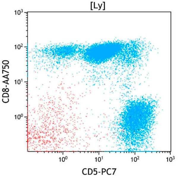 ClearLLab 10C, Case 16, CD5 vs CD8 dot plot, Lymphocyte gate