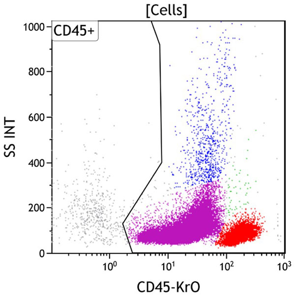  ClearLLab 10C, Case 18, CD45 vs Side Scatter, Cells gate 