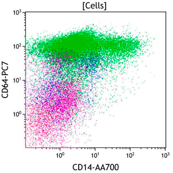 Acute Monocytic Leukemia
