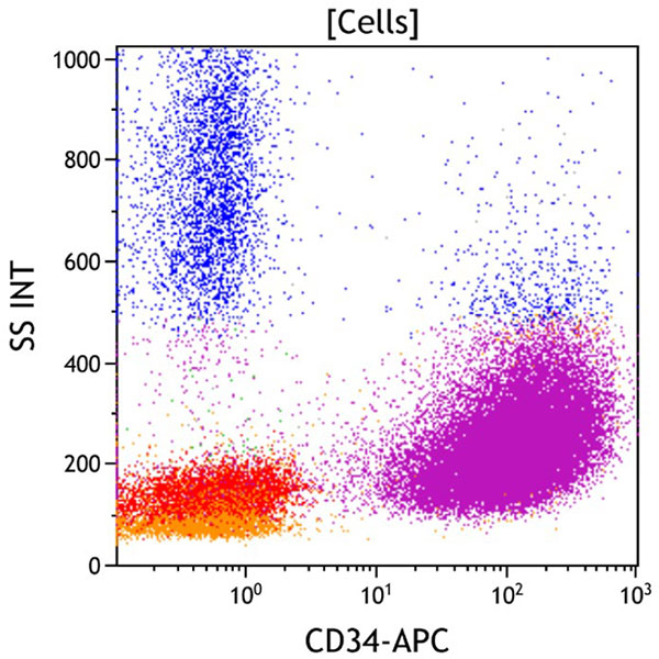 ClearLLab 10C, Case 4, CD34 vs Side Scatter dot plot, all viable cells