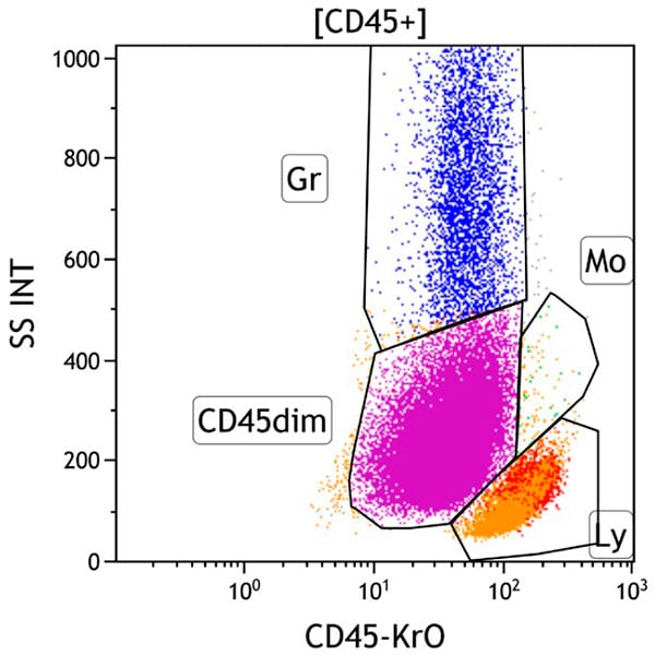 ClearLLab 10C, Case 4, CD45 vs Side Scatter dot plot, CD45+ gate