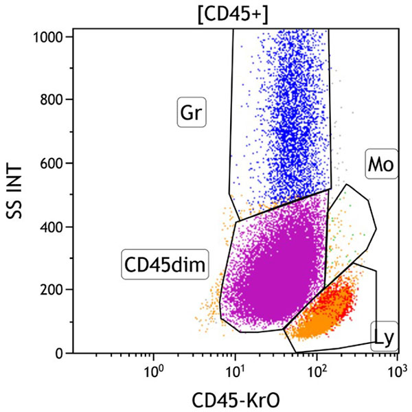 ClearLLab 10C, Case 4, CD45 vs Side Scatter dot plot, CD45+ gate