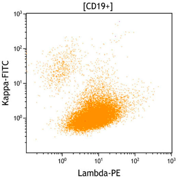 ClearLLab 10C, Case 7, Lambda vs Kappa dot plot