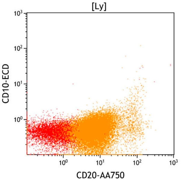 ClearLLab 10C, Case 7, CD20 vs CD10 dot plot, lymphocyte gate
