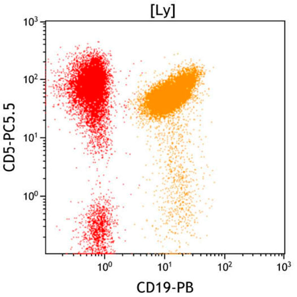 ClearLLab 10C, Case 7, CD19 vs CD5 dot plot, lymphocyte gate