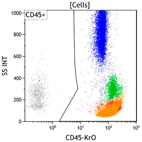 ClearLLab 10C, Case 7, CD45 vs Side Scatter dot plot, Cells gate
