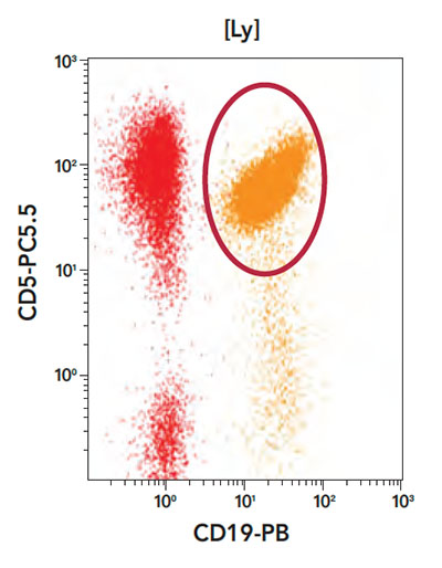 Phenotyping profile CD19 vs CD5