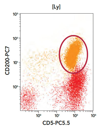 Phenotyping profile CD5 vs CD200
