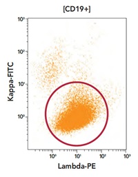 Phenotyping profile Lambda vs Kappa