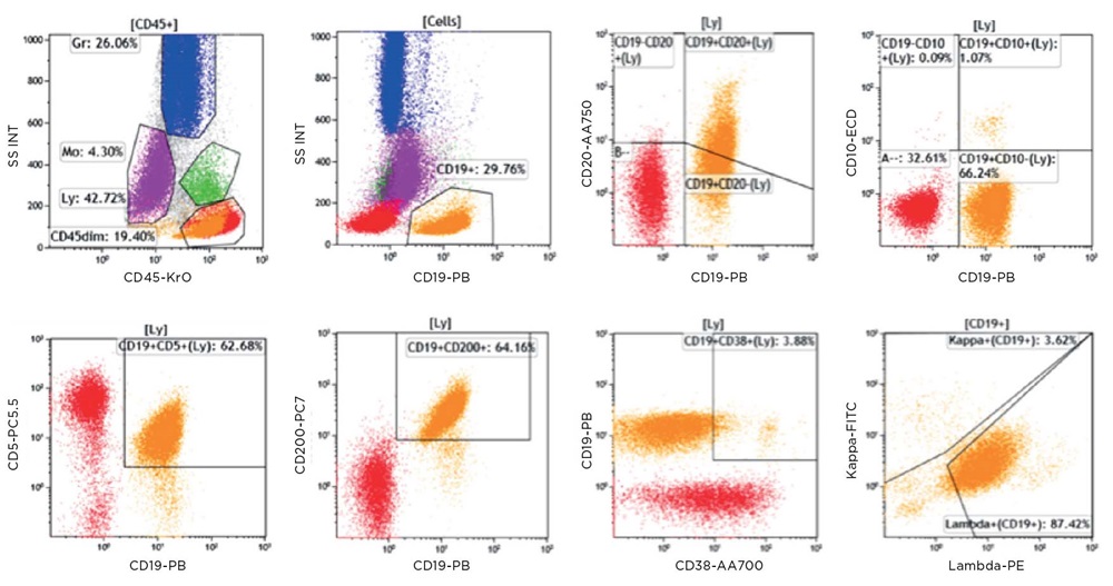 Patient sample immunophenotyping results using ClearLLab 10C B Cell Tube, figure 1a