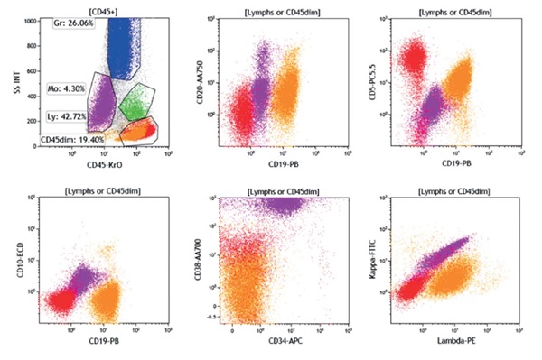 Patient sample immunophenotyping results using ClearLLab 10C B Cell Tube, figure 1b