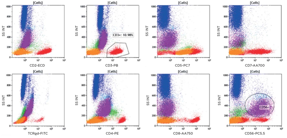 Patient sample immunophenotyping results using ClearLLab 10C T Cell Tube, figure 2