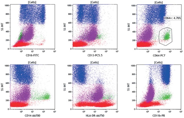 Patient sample immunophenotyping results using ClearLLab 10C M1 Cell Tube, figure 3
