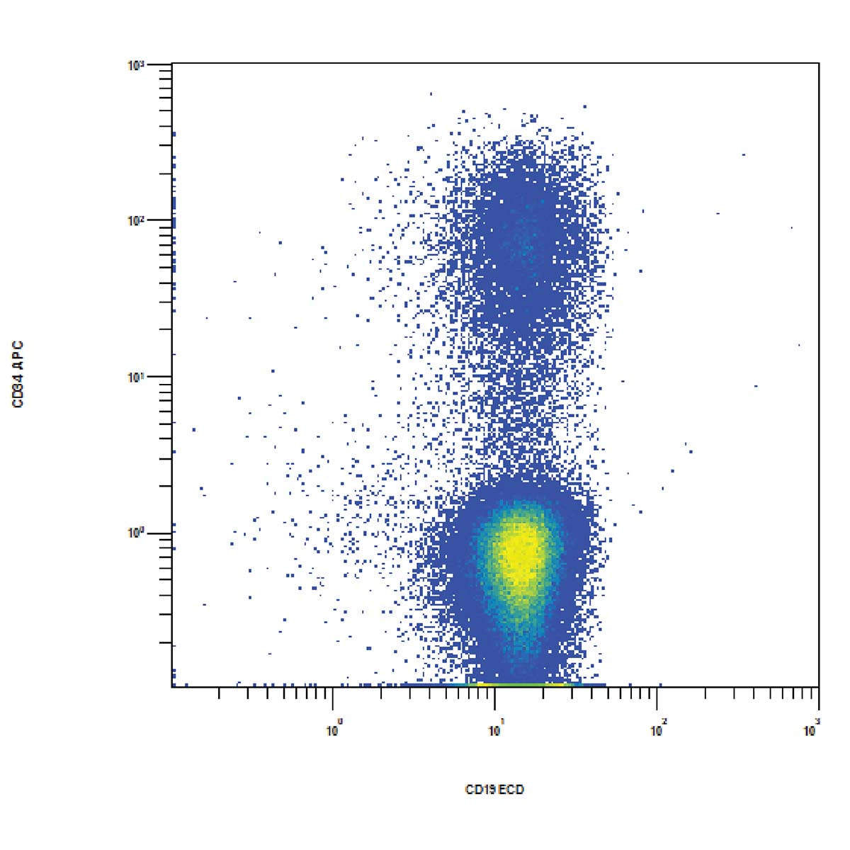 Figure A displays strong CD34 expression on a portion of CD19+ CD45 dim blasts.
