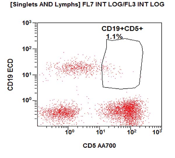 Gating strategy to assess the T, B and NK cell subpopulations. CD5 vs CD19 dot plot.