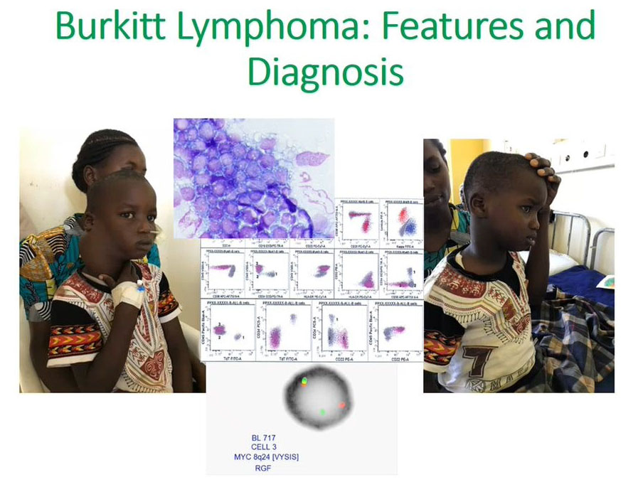 Flow Cytometry Pediatric Cancer Diagnosis Webinar, Slide 9
