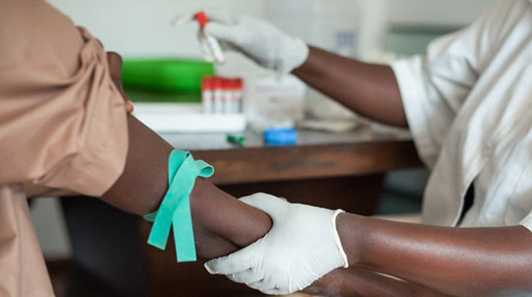 HIV Diagnosis Becomes up to Four Times Faster Thanks to This Invention