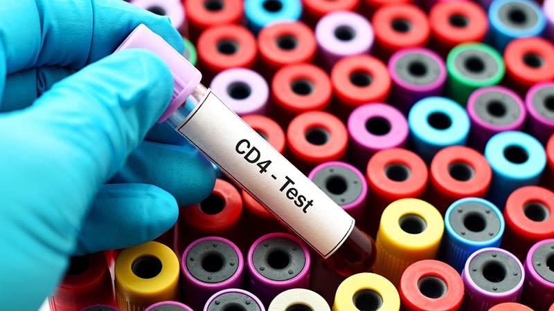 12 steps to CD4 testing, part 1 – HIV testing