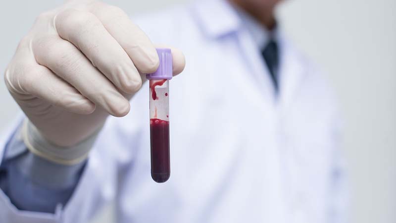 Man holding K3 EDTA tube with blood sample