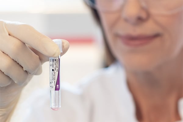 Lab technician holding a ClearLLab tube