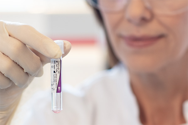 Lab technician holding a ClearLLab tube