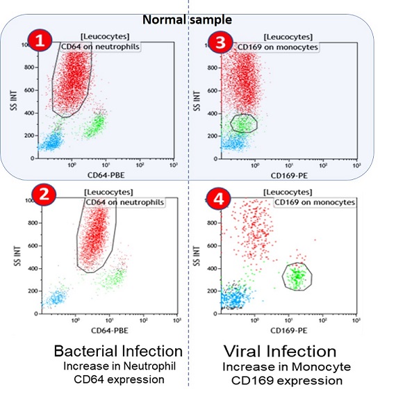 Flow cytometric plots representing the expression of CD64 upon bacterial infection and CD169 upon viral infection