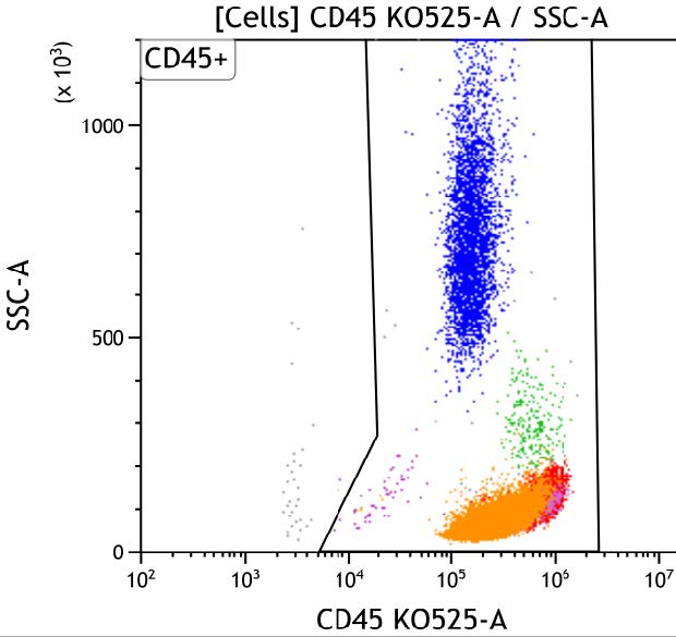Casebook ClearLLab 10C, case 2, illustration B04, CD45 vs Side Scatter, gated on Cells