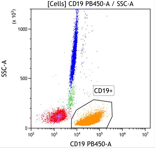 Casebook ClearLLab 10C, case 2, illustration B06, CD19 vs Side Scatter, gated on Cells