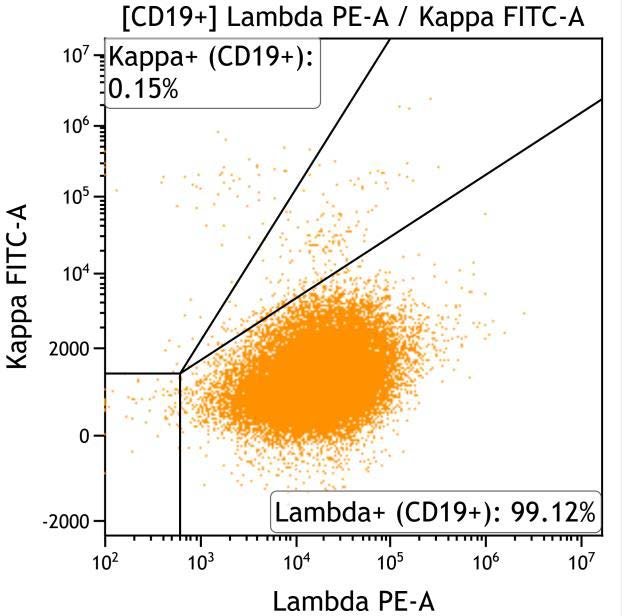 Casebook ClearLLab 10C, case 2, illustration B15, Lambda vs Kappa, gated on CD19+