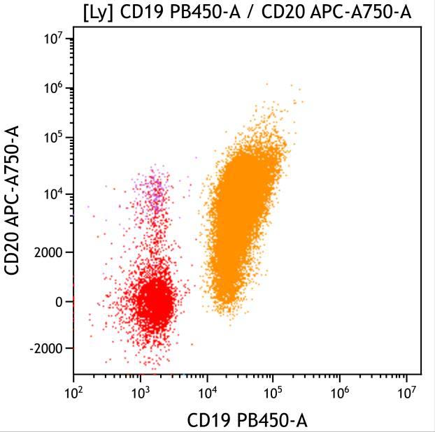  Casebook ClearLLab 10C, case 2, illustration B16, CD19 vs CD20 gated on Lymphocytes