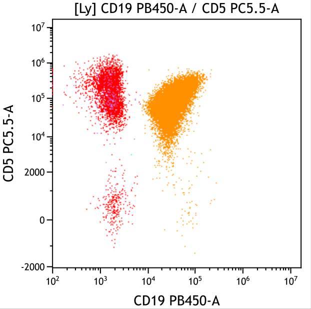Casebook ClearLLab 10C, case 2, illustration B20, CD19 vs CD5, gated on Lymphocytes
