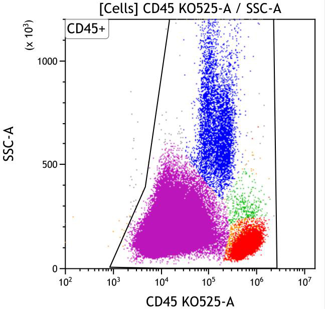 Casebook ClearLLab 10C, case 3, illustration B04, CD45 vs Side Scatter, gated on Cells