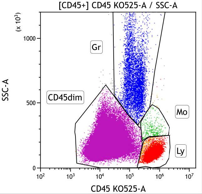 Casebook ClearLLab 10C, case 3, illustration B05, CD45 vs Side scatter, gated on CD45+