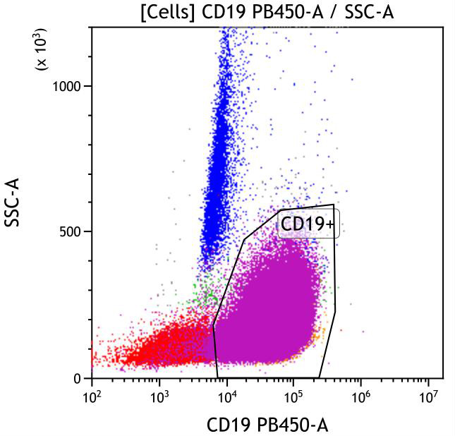 Casebook ClearLLab 10C, case 3, illustration B06, CD19 vs Side scatter, gated on Cells