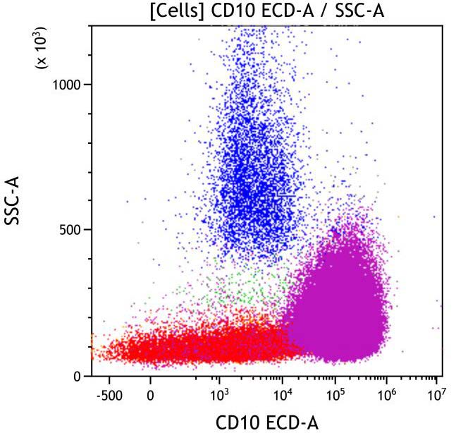 Casebook ClearLLab 10C, case 3, illustration B09, CD10 vs Side scatter, gated on Cells