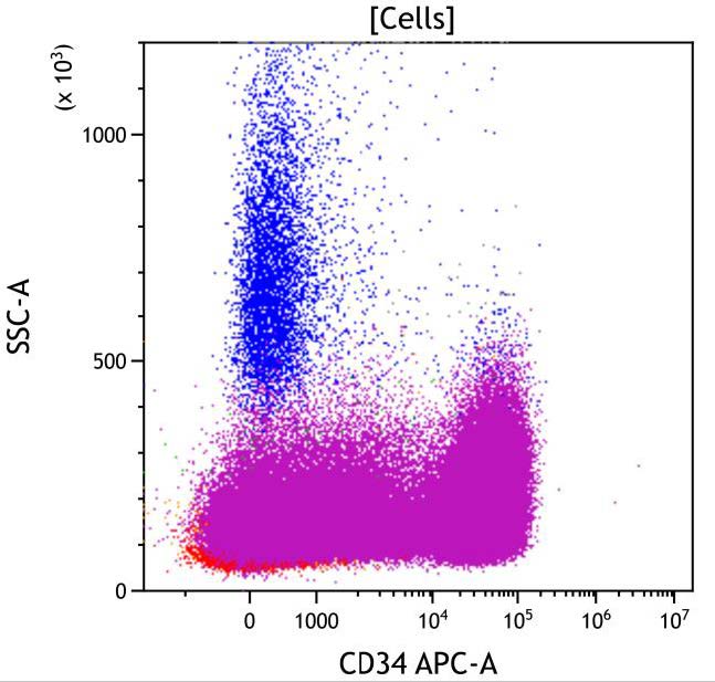  Casebook ClearLLab 10C, case 3, illustration B12, CD34 vs Side scatter, gated on Cells