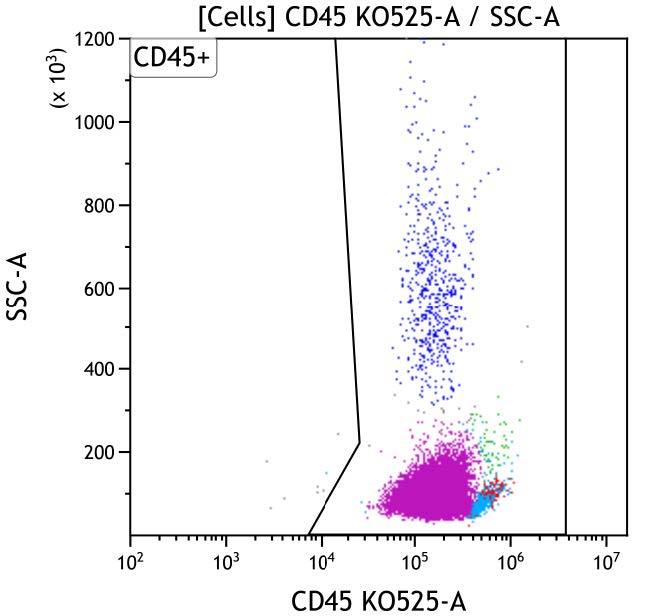 Casebook ClearLLab 10C, case 5, illustration T04, CD45 vs Side scatter, gated on Cells