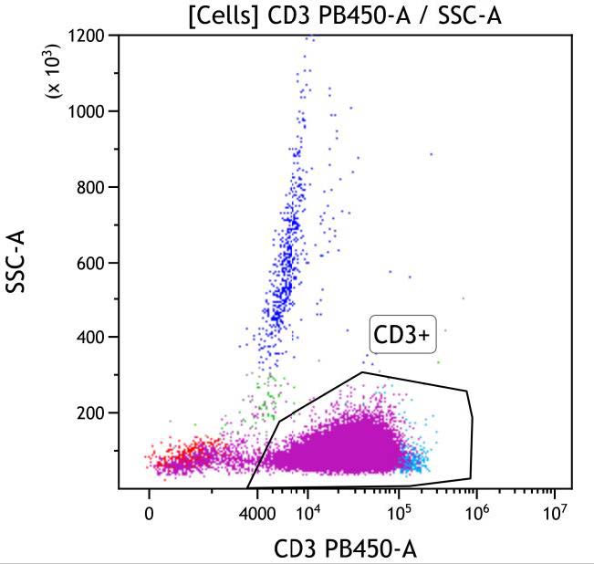 Casebook ClearLLab 10C, case 5, illustration T06, CD3 vs Side scatter, gated on Cells