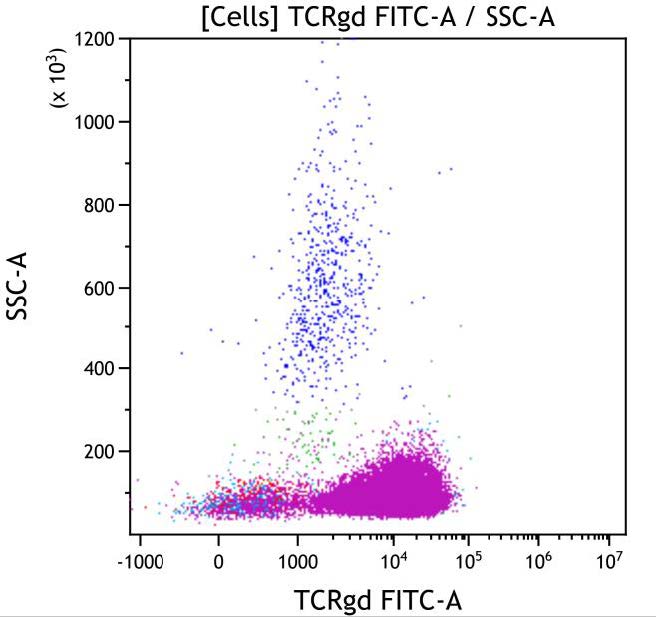 Casebook ClearLLab 10C, case 5, illustration T07, TCRgd vs Side scatter, gated on Cells