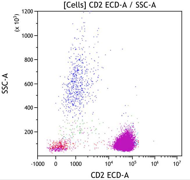 Casebook ClearLLab 10C, case 5, illustration T09, CD2 vs Side scatter, gated on Cells