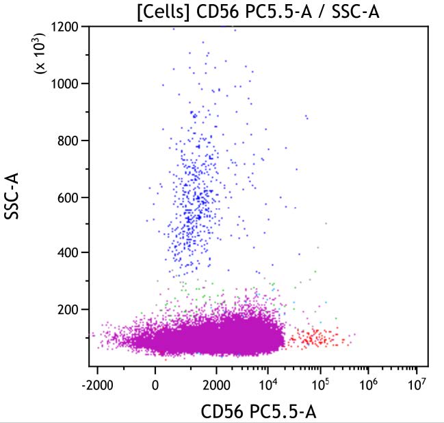  Casebook ClearLLab 10C, case 5, illustration T10, CD56 vs Side scatter, gated on Cells