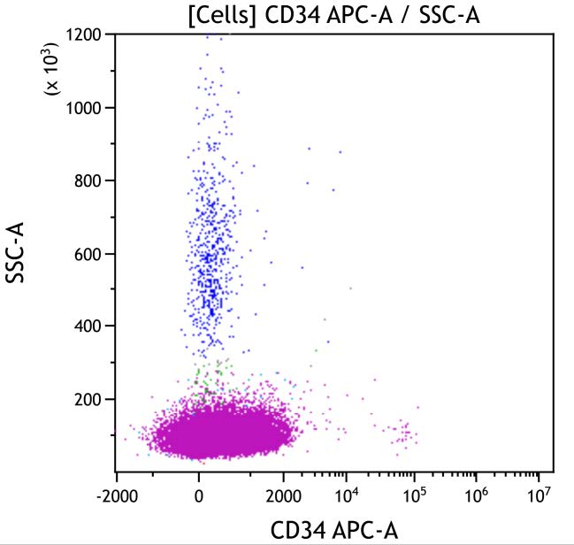 Casebook ClearLLab 10C, case 5, illustration T12, CD34 vs Side scatter, gated on Cells